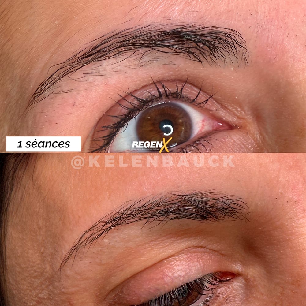 Sourcils : avant / après