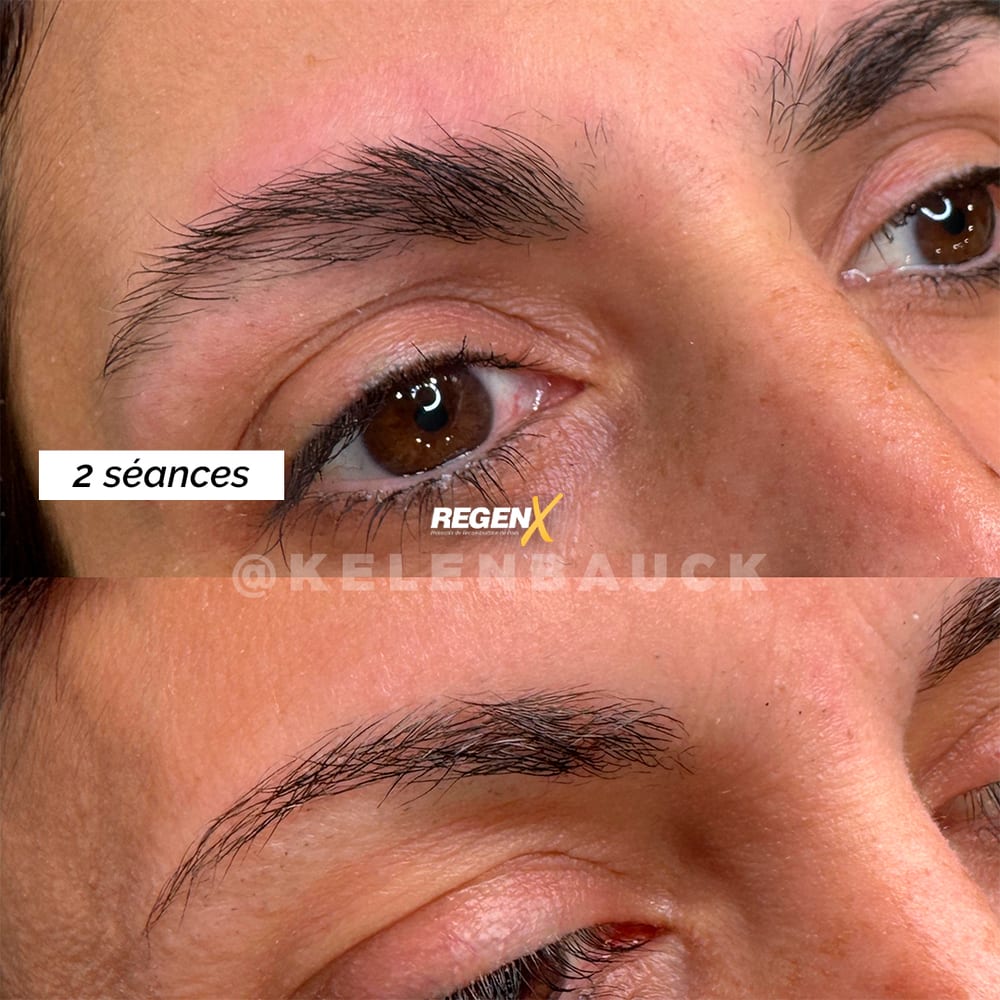 Sourcils : avant / après