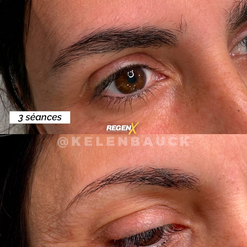 Sourcils : avant / après